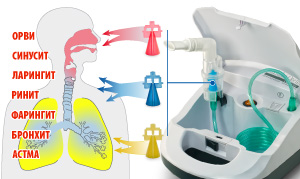 Ингалятор Little Doctor LD 210С компрессорный (3 распылителя)